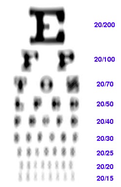 Astigmatism Simulator – Oftalmo University